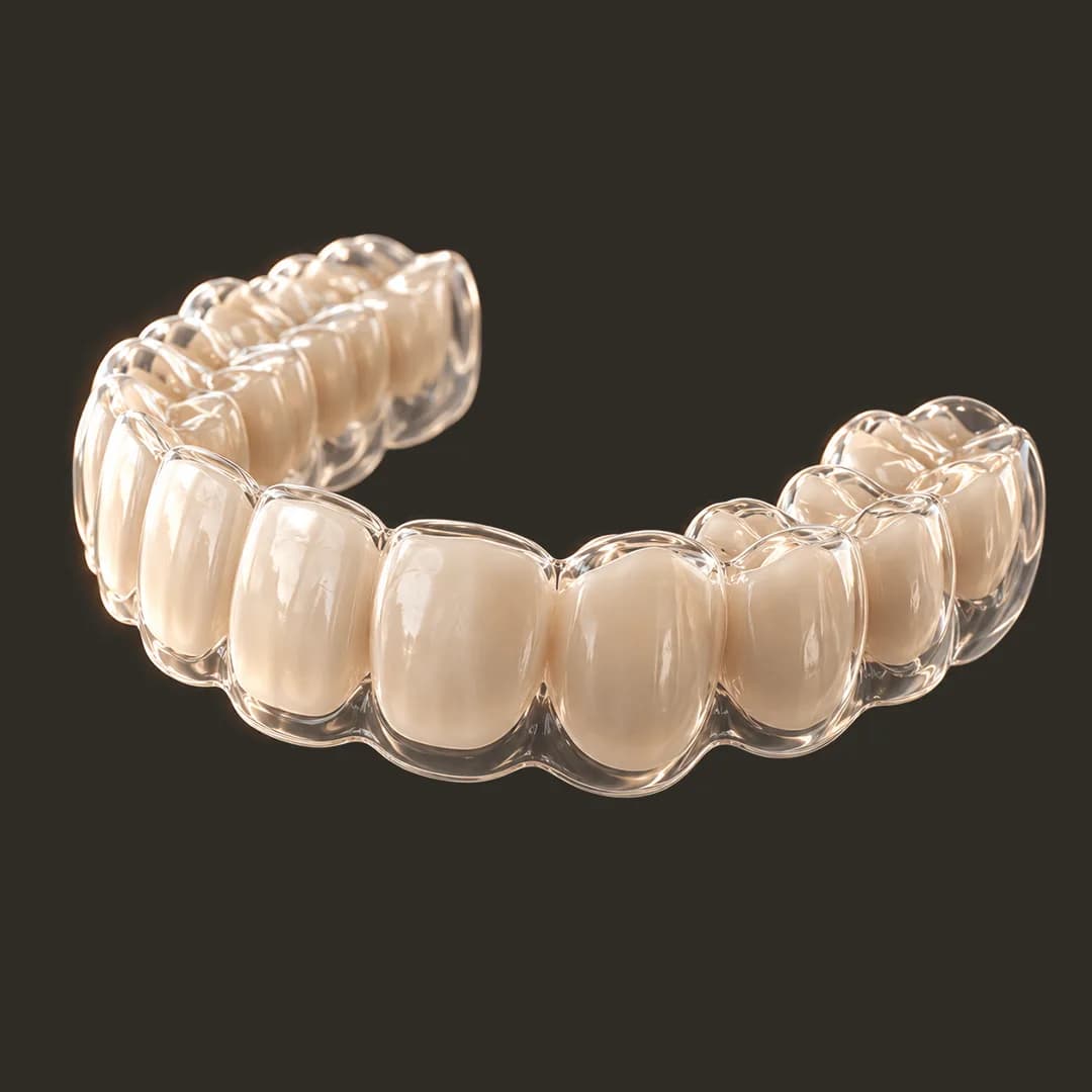 Clear Aligners