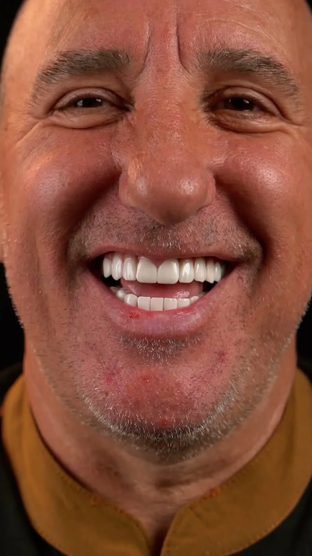 Patient film